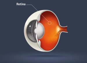 Benefits and Side Effects of Intravitreal Injections for Eye Diseases