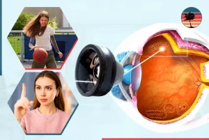 How to Improve Peripheral Vision: Simple Steps for Better Side Vision