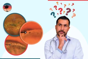 What Is Lattice Degeneration: Everything You Need to Know