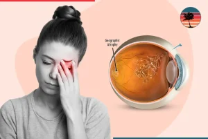 Understanding Syfovre Side Effects and How to Manage Them?