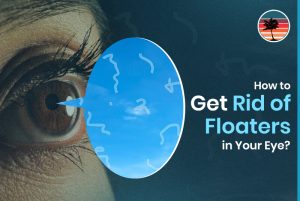 How To Get Rid Of Floaters In Your Eye?