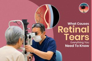 What Causes Retinal Tears? Everything You Need To Know