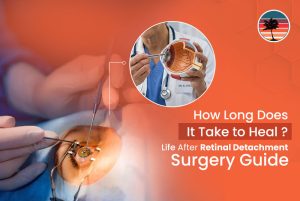 How Long Does It Take to Heal? Life After Retinal Detachment Surgery Guide