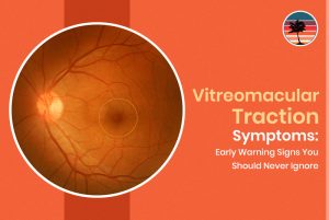 Vitreomacular Traction Symptoms: Early Waring Signs You Should Never Ignore