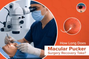 How Long Does Macular Pucker Surgery Recovery Take?