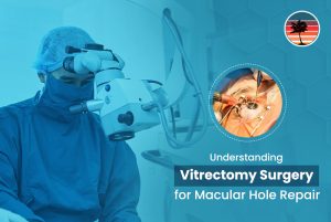Understanding Vitrectomy Surgery for Macular Hole Repair