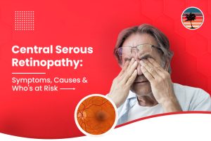 Central Serous Retinopathy: Symptoms, Causes & Who’s At Risk